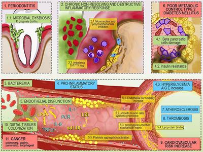 Diabetes, periodontitis, and cardiovascular disease: towards equity in diabetes care